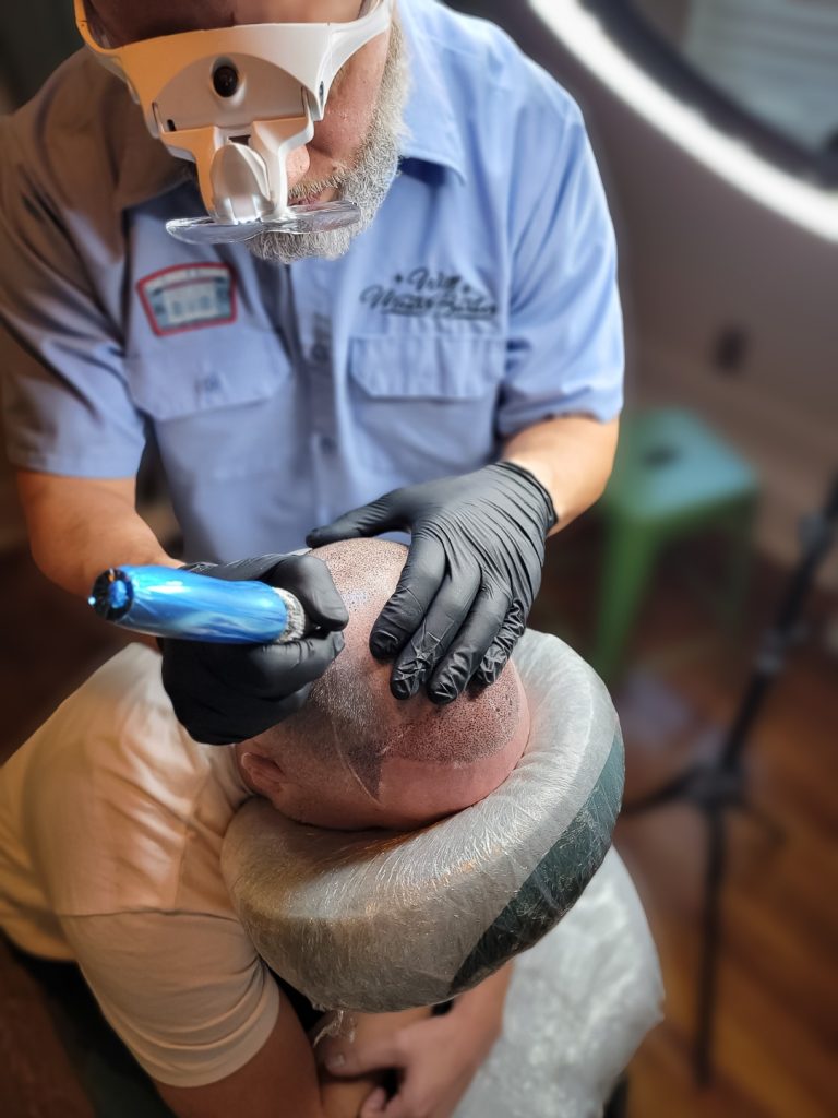 Scalp Micropigmentation Services Scalp Micropigmentation Services